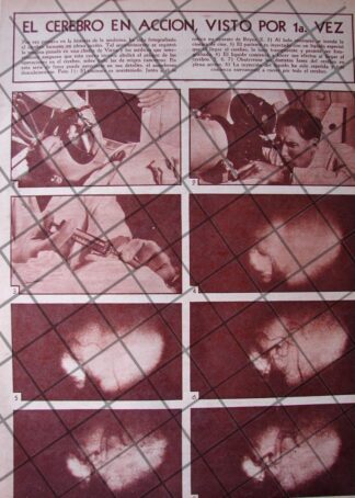 AFICHE ANTIGUO LA 1RA RADIOGRAFIA DEL CEREBRO FUNCIONANDO